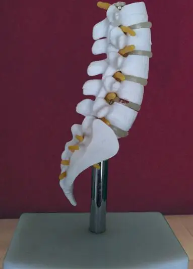 15cm Skeletas Juosmens Diskų Ligos, Stuburo Modelis Penktasis skirsnis juosmeninės stuburo Medicinos Mokslo, Mokymo Klubų kūno manekenai C010